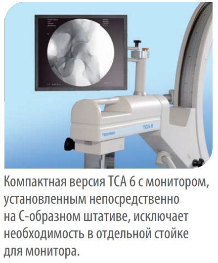 Мобильная С-дуга TECHNIX TCA 6 R/S